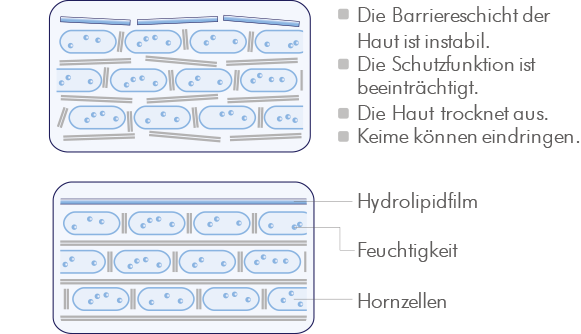 Die Wirkung von Hautpflege bei Neurodermitis Schema zur Wirkung von Hautpflege bei Neurodermitis